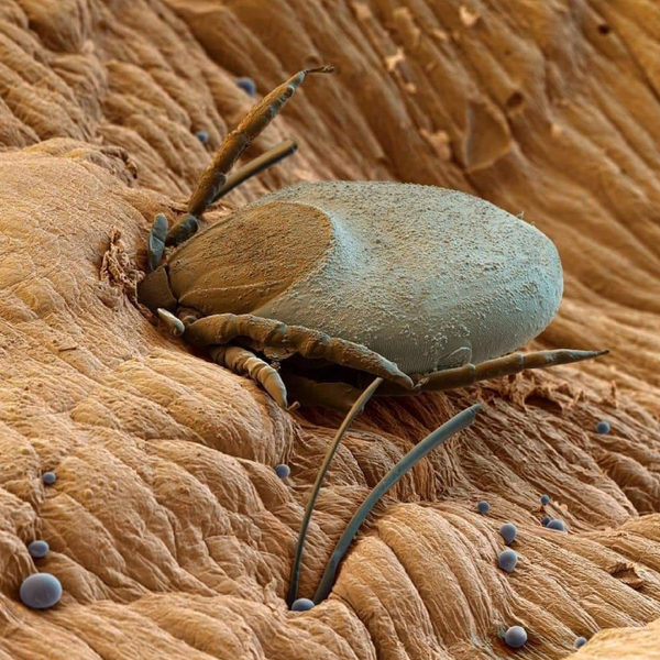 Antiparasitarios