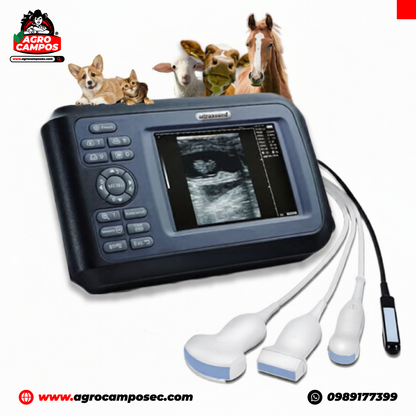 Escáner de Ultrasonido Portátil con Sonda Convexa Rectal